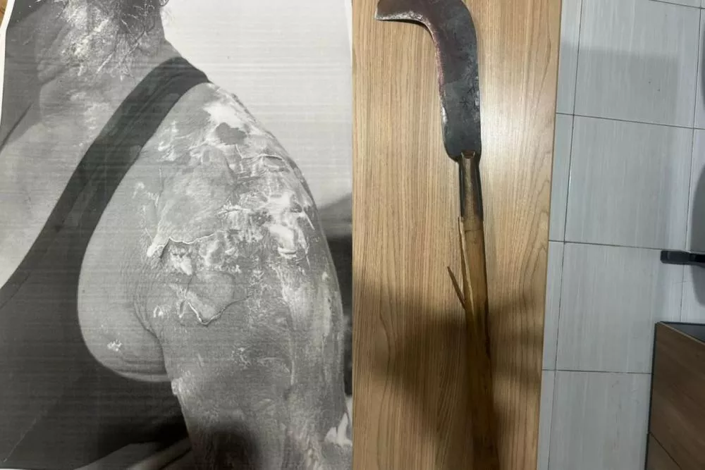 Homem é preso após jogar feijão quente na companheira