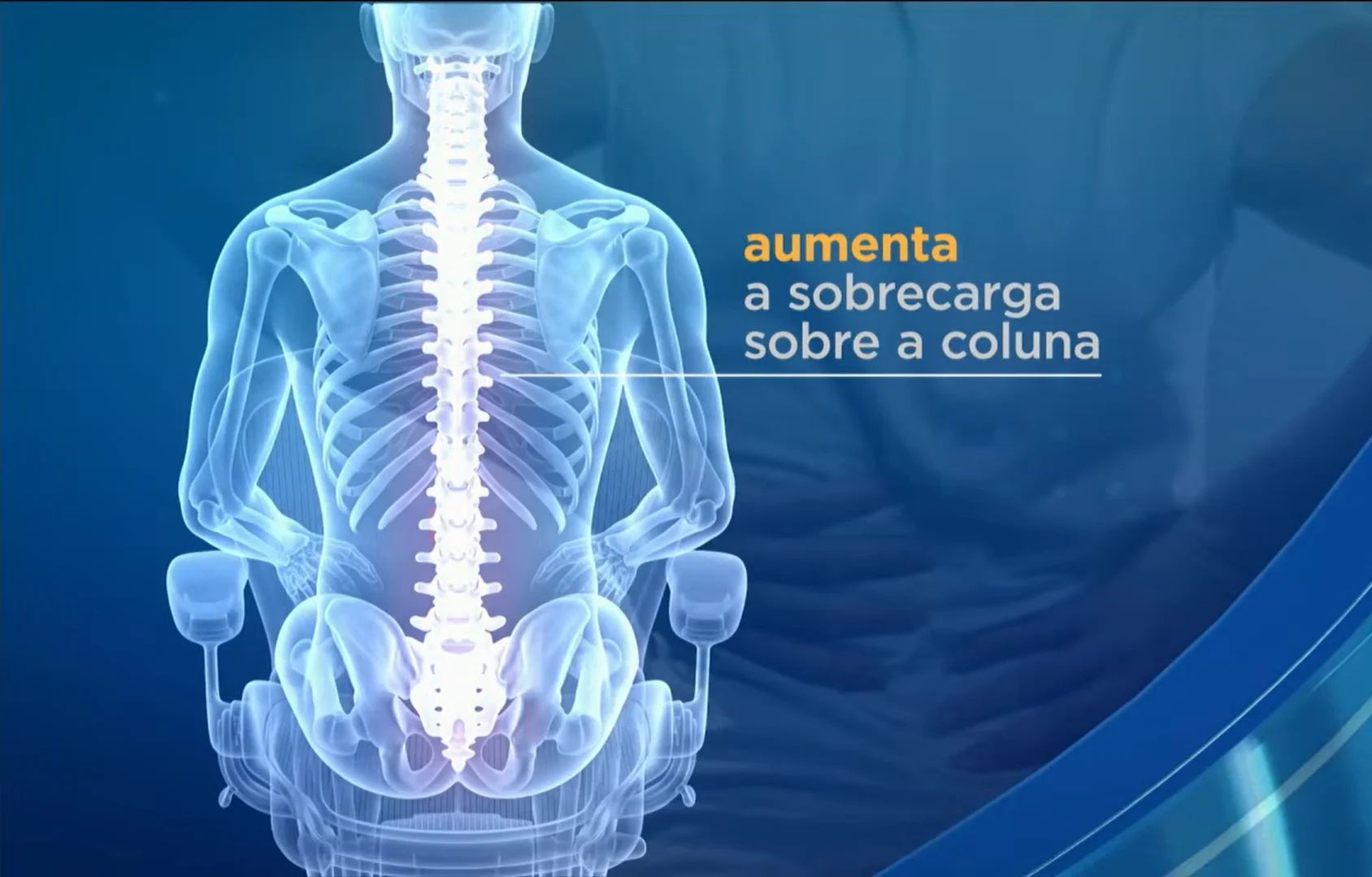 Especialistas alertam para os riscos do sedentarismo à coluna