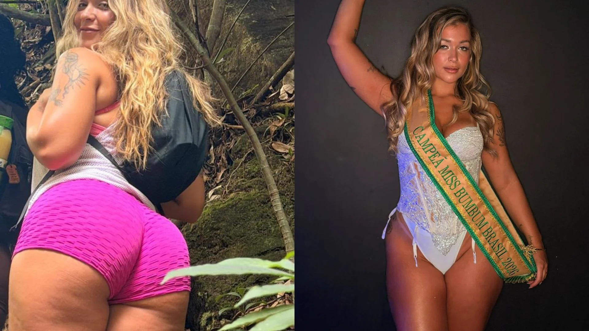 Miss Bumbum 2026 diz ter descoberto lipedema em trilha